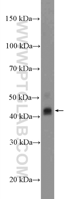 Western Blot (WB) analysis of MCF-7 cells using Amphiregulin Polyclonal antibody (16036-1-AP)