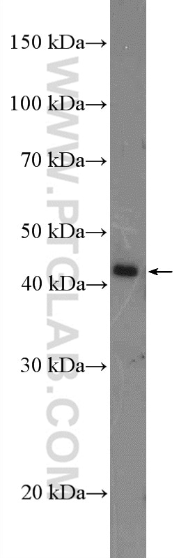 Western Blot (WB) analysis of A549 cells using Amphiregulin Polyclonal antibody (16036-1-AP)