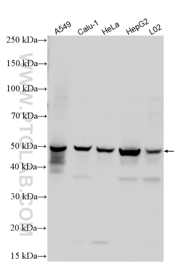 WB analysis using 16036-1-AP Western Blot (WB) analysis of various lysates using Amphiregulin Polyclonal antibody (16036-1-AP)