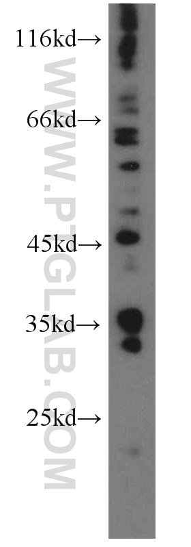 Western Blot (WB) analysis of HepG2 cells using Amphiregulin Polyclonal antibody (16036-1-AP)