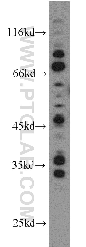 Western Blot (WB) analysis of MCF-7 cells using Amphiregulin Polyclonal antibody (16036-1-AP)