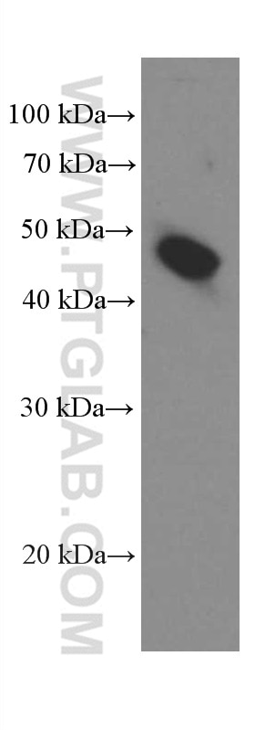 Western Blot (WB) analysis of MCF-7 cells using Amphiregulin Monoclonal antibody (66433-1-Ig)