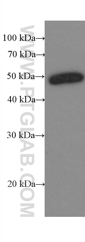 Western Blot (WB) analysis of rat brain tissue using Amphiregulin Monoclonal antibody (66433-1-Ig)