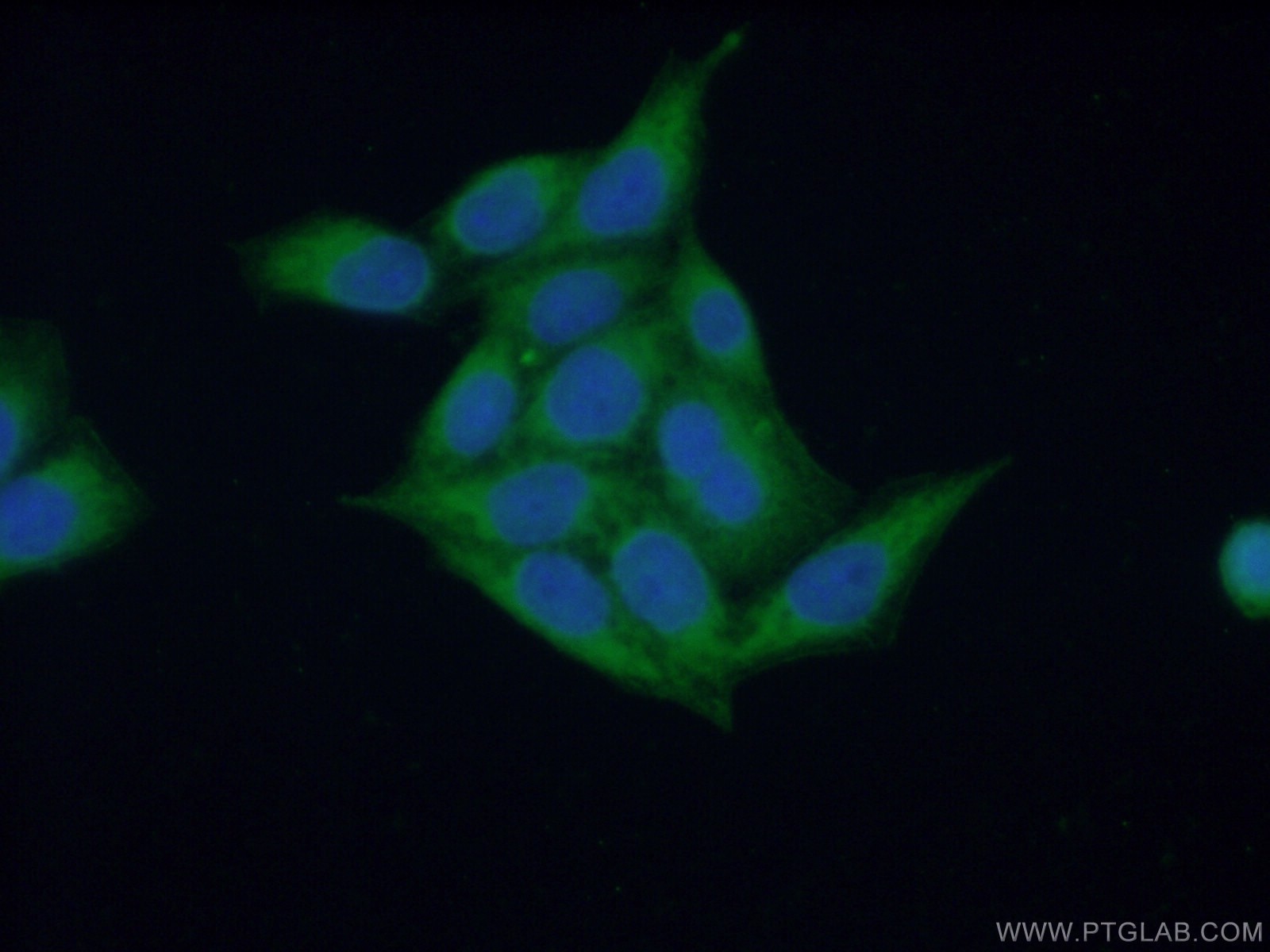 Immunofluorescence (IF) / fluorescent staining of HeLa cells using ARF1 Polyclonal antibody (10790-1-AP)