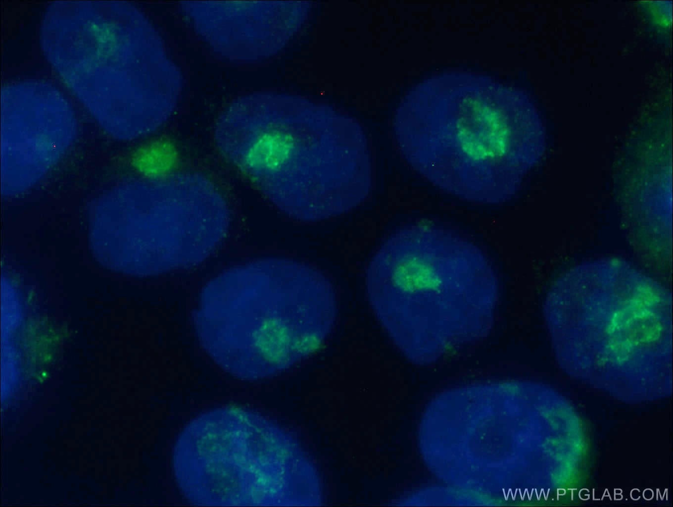 Immunofluorescence (IF) / fluorescent staining of HeLa cells using ARF1 Polyclonal antibody (10790-1-AP)