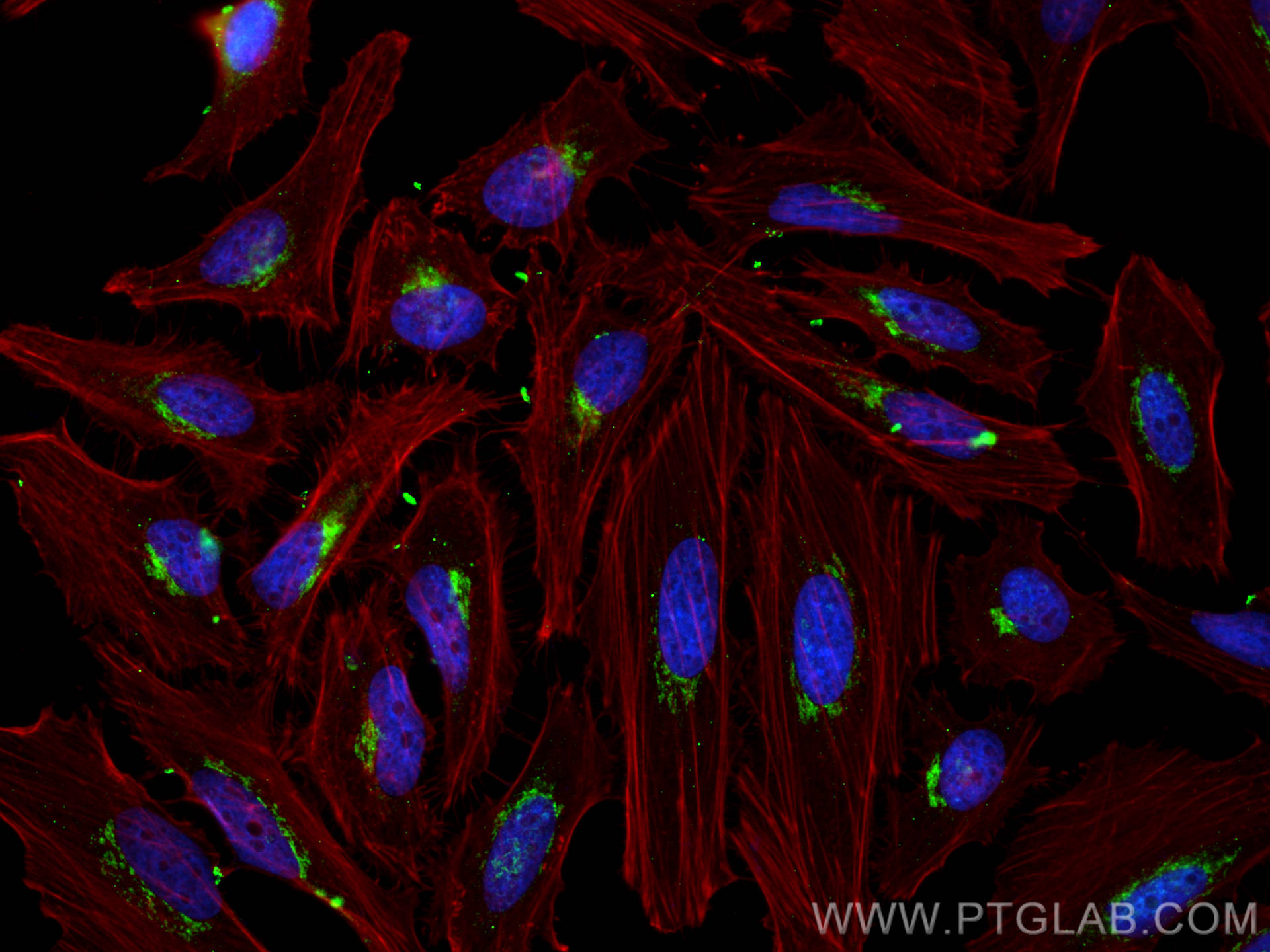 IF Staining of HeLa using 10790-1-AP