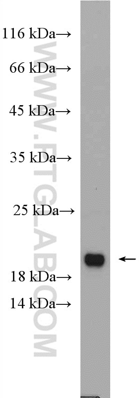 Western Blot (WB) analysis of rat brain tissue using ARF1 Polyclonal antibody (10790-1-AP)