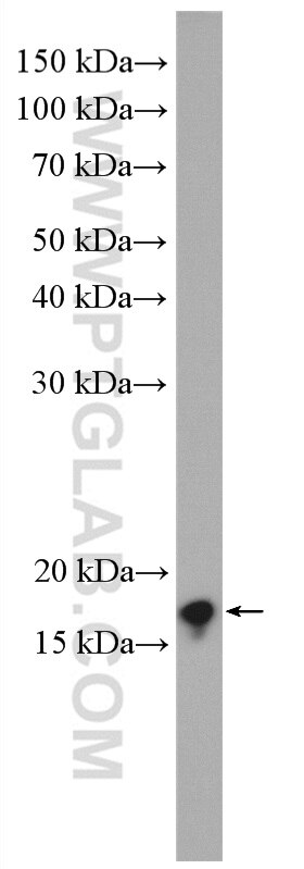 Western Blot (WB) analysis of HEK-293 cells using ARF1 Polyclonal antibody (10790-1-AP)