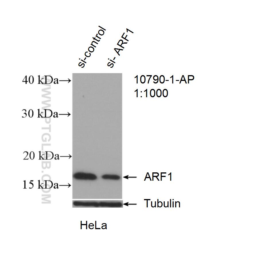 Western Blot (WB) analysis of HeLa cells using ARF1 Polyclonal antibody (10790-1-AP)