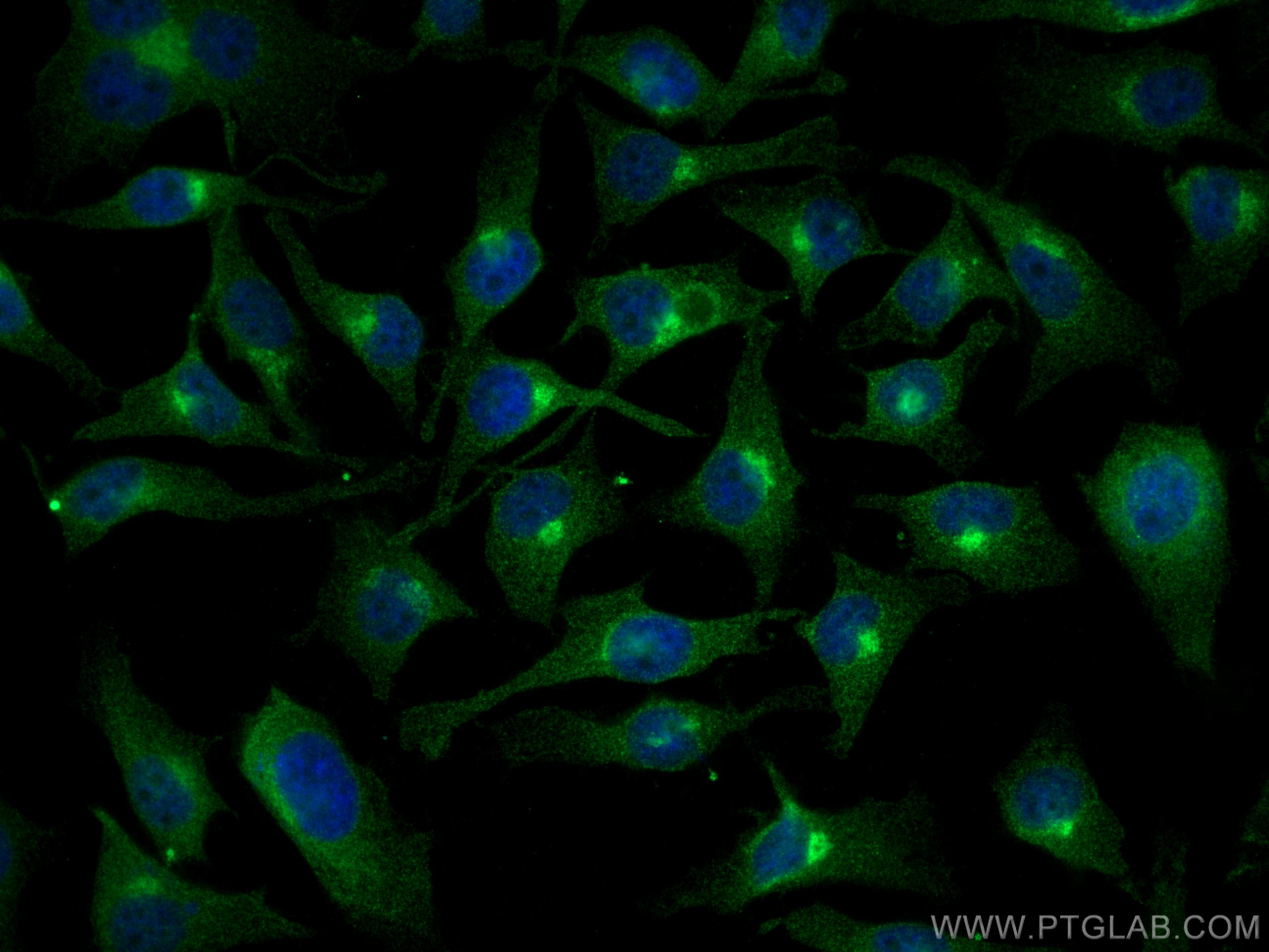 IF Staining of HeLa using 68069-1-Ig