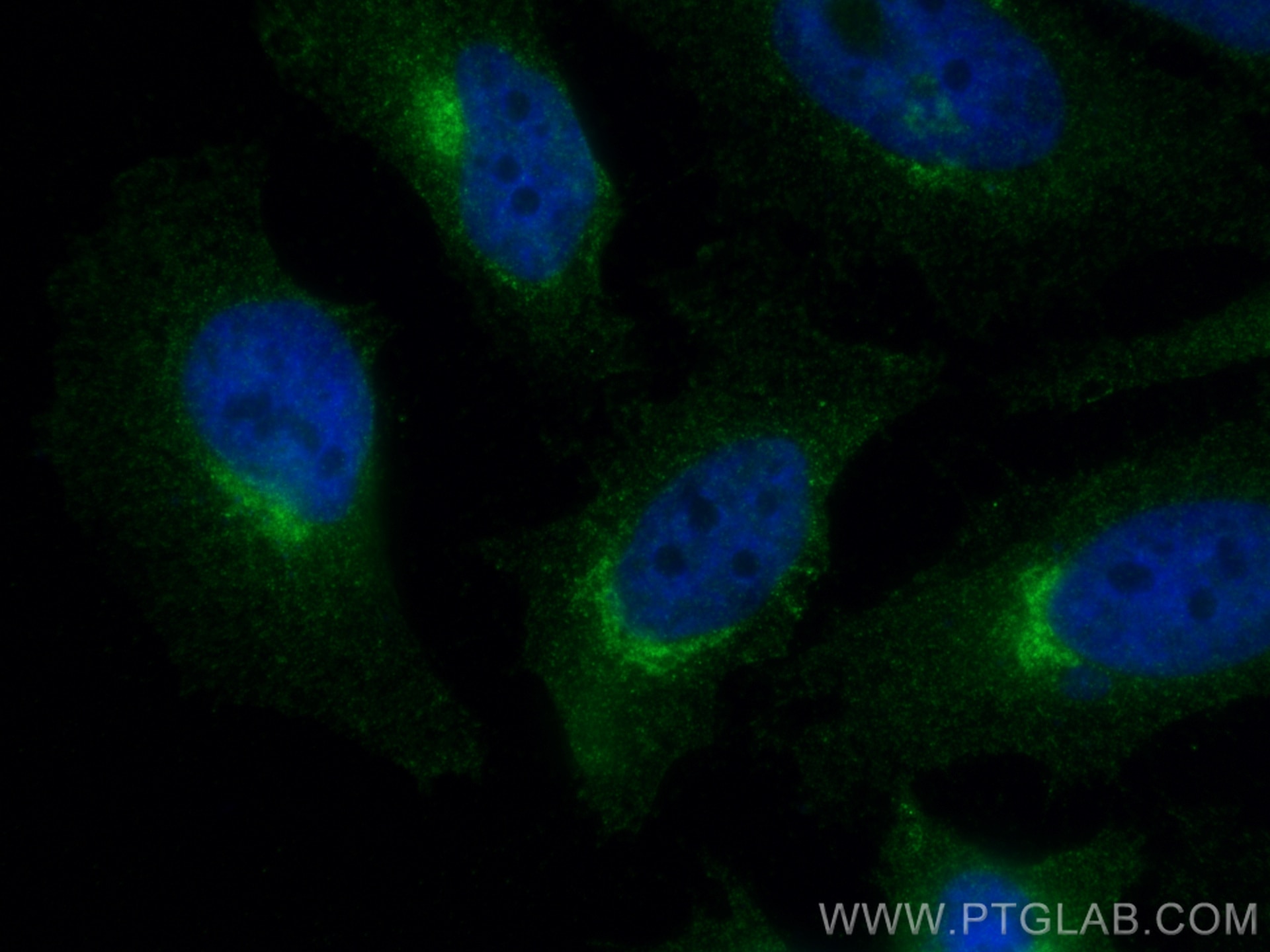 Immunofluorescence (IF) / fluorescent staining of HeLa cells using ARF1 Monoclonal antibody (68069-1-Ig)