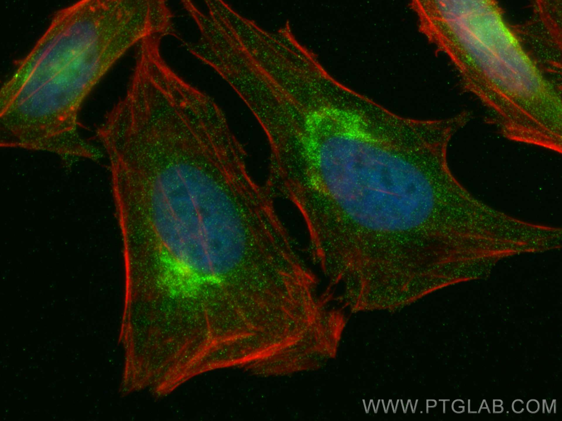 Immunofluorescence (IF) / fluorescent staining of HeLa cells using ARF1 Monoclonal antibody (68069-1-Ig)