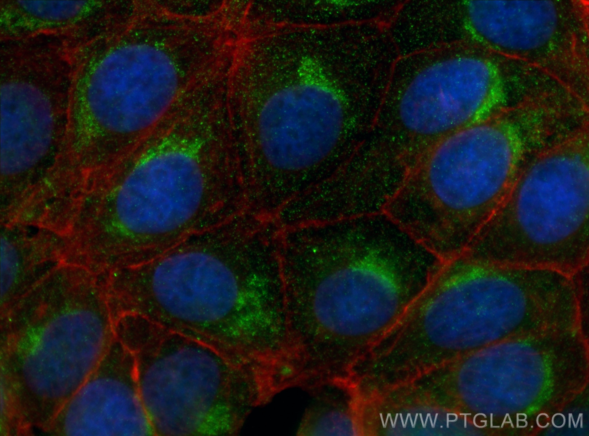 Immunofluorescence (IF) / fluorescent staining of MCF-7 cells using ARF1 Monoclonal antibody (68069-1-Ig)