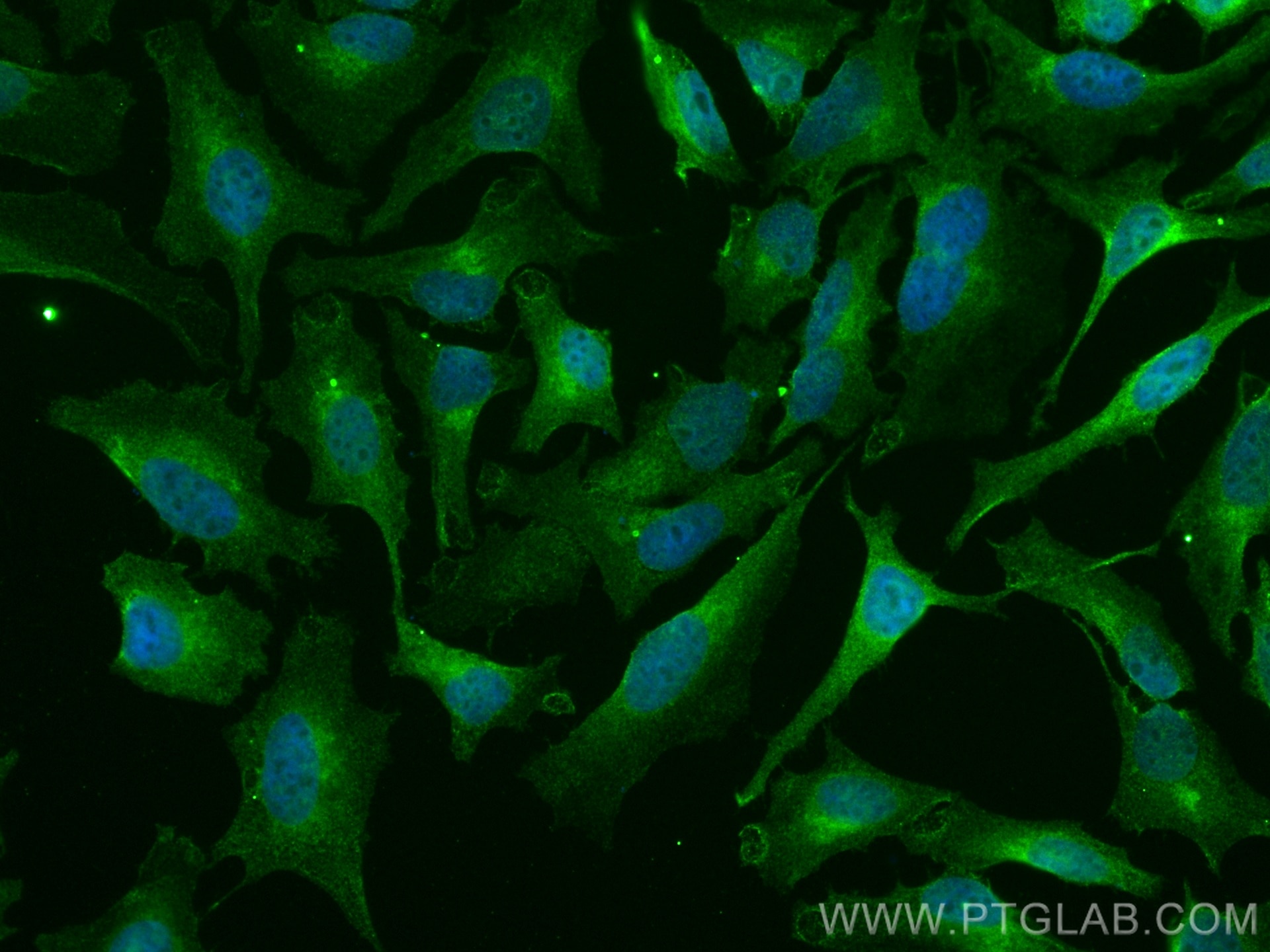 Immunofluorescence (IF) / fluorescent staining of HeLa cells using CoraLite® Plus 488-conjugated ARF1 Monoclonal anti (CL488-68069)