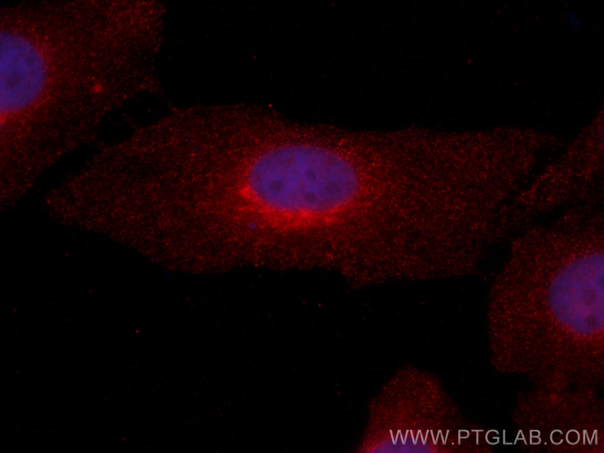 Immunofluorescence (IF) / fluorescent staining of HeLa cells using CoraLite®594-conjugated ARF1 Monoclonal antibody (CL594-68069)