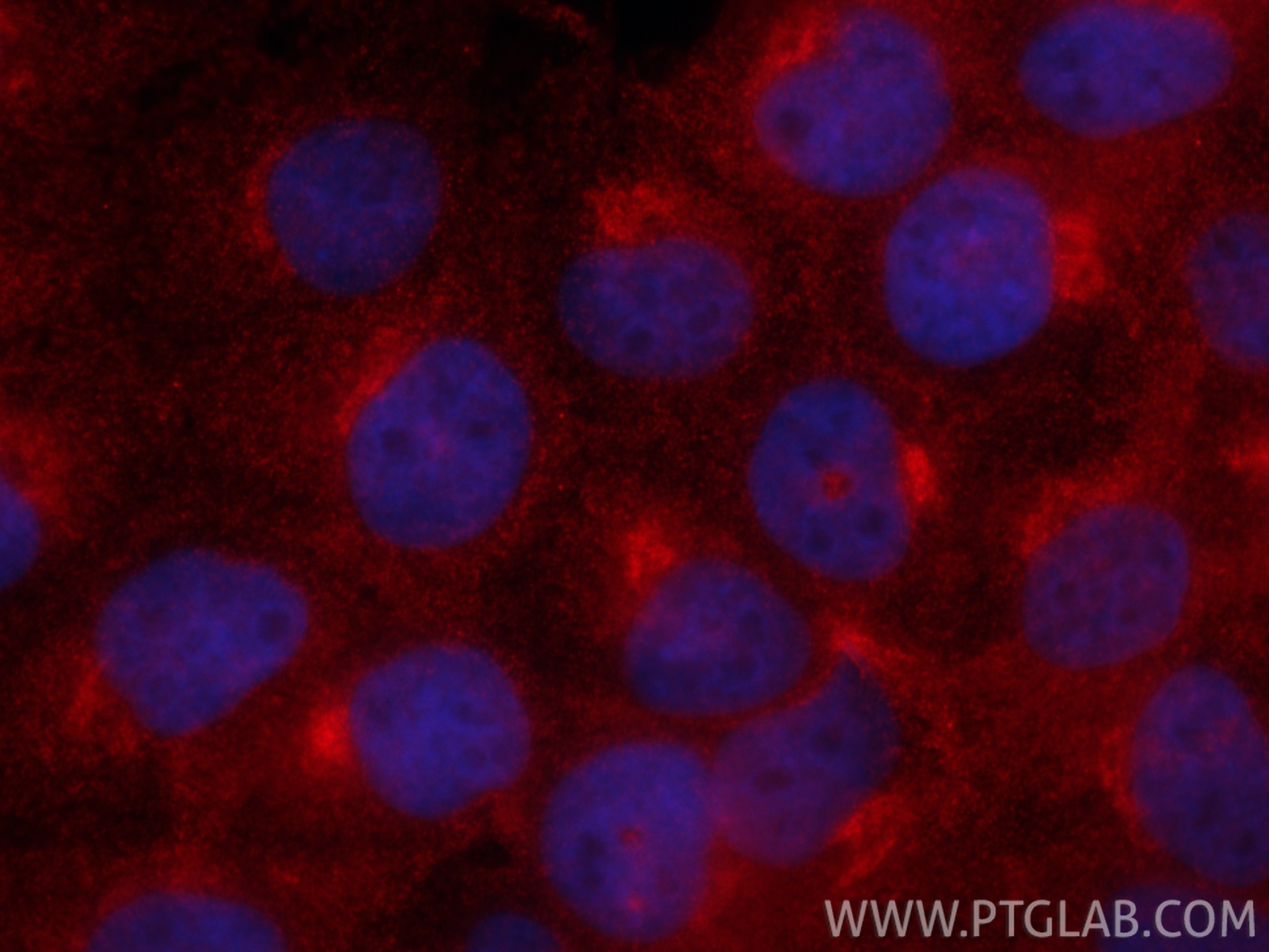 Immunofluorescence (IF) / fluorescent staining of A431 cells using CoraLite®594-conjugated ARF1 Monoclonal antibody (CL594-68069)