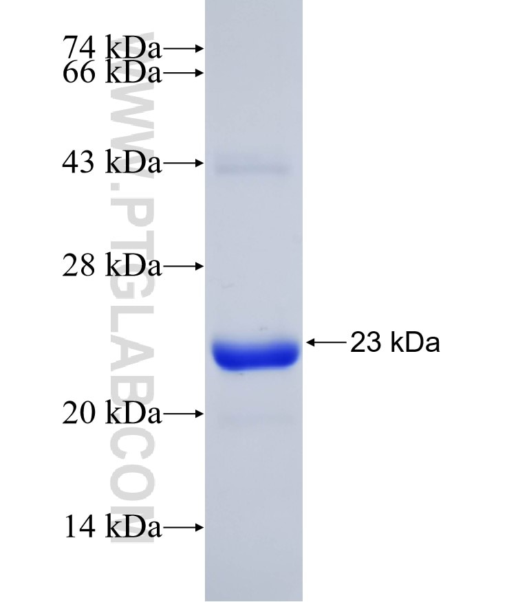 ARF1 fusion protein Ag28021 SDS-PAGE