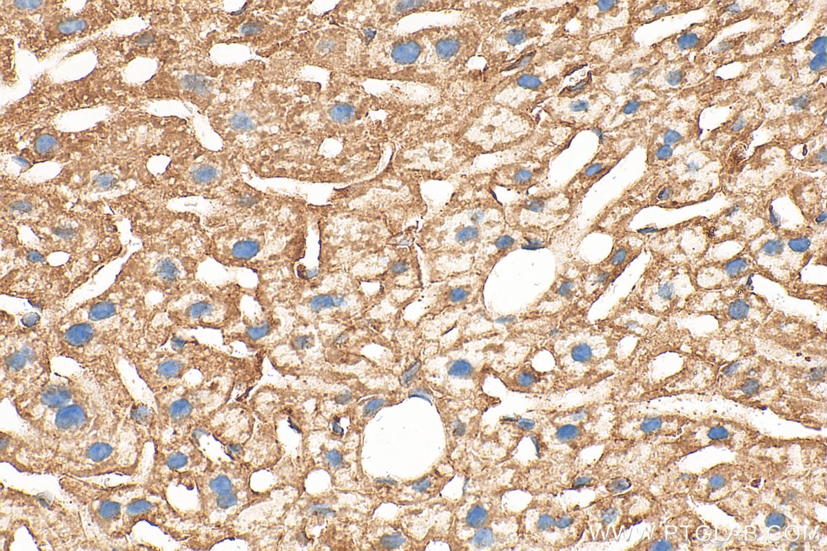 Immunohistochemistry (IHC) staining of mouse liver tissue using ARF1 Polyclonal antibody (20226-1-AP)