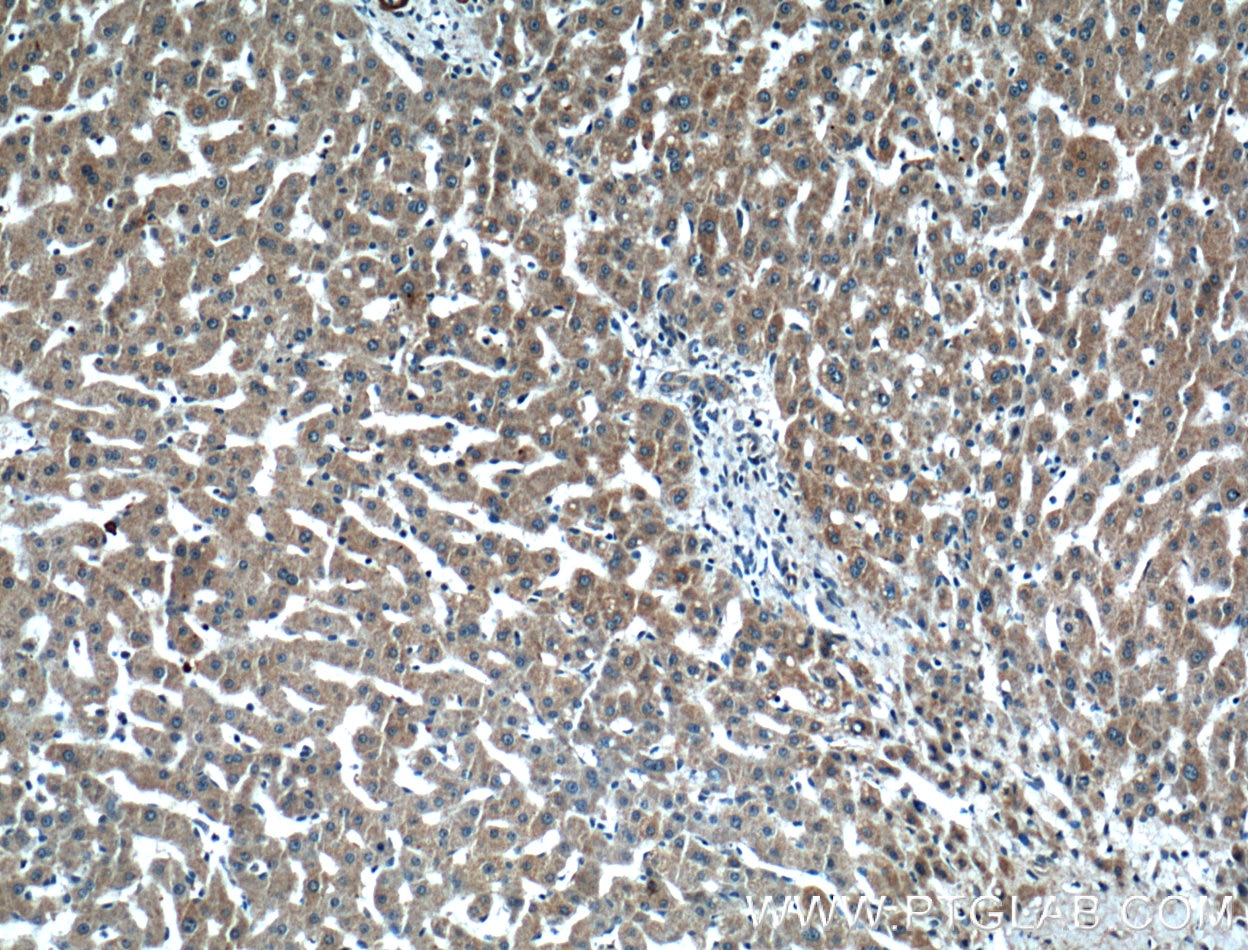 Immunohistochemistry (IHC) staining of human liver tissue using ARF1 Polyclonal antibody (20226-1-AP)
