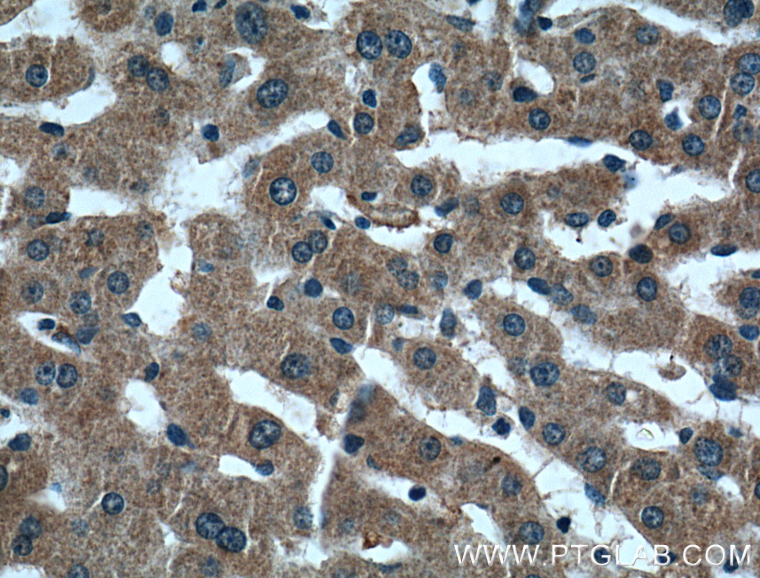 Immunohistochemistry (IHC) staining of human liver tissue using ARF1 Polyclonal antibody (20226-1-AP)