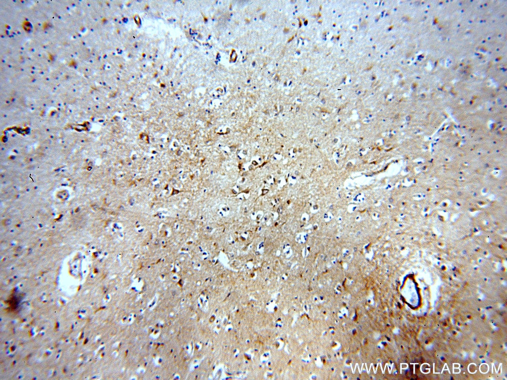 Immunohistochemistry (IHC) staining of human brain tissue using ARF1 Polyclonal antibody (20226-1-AP)