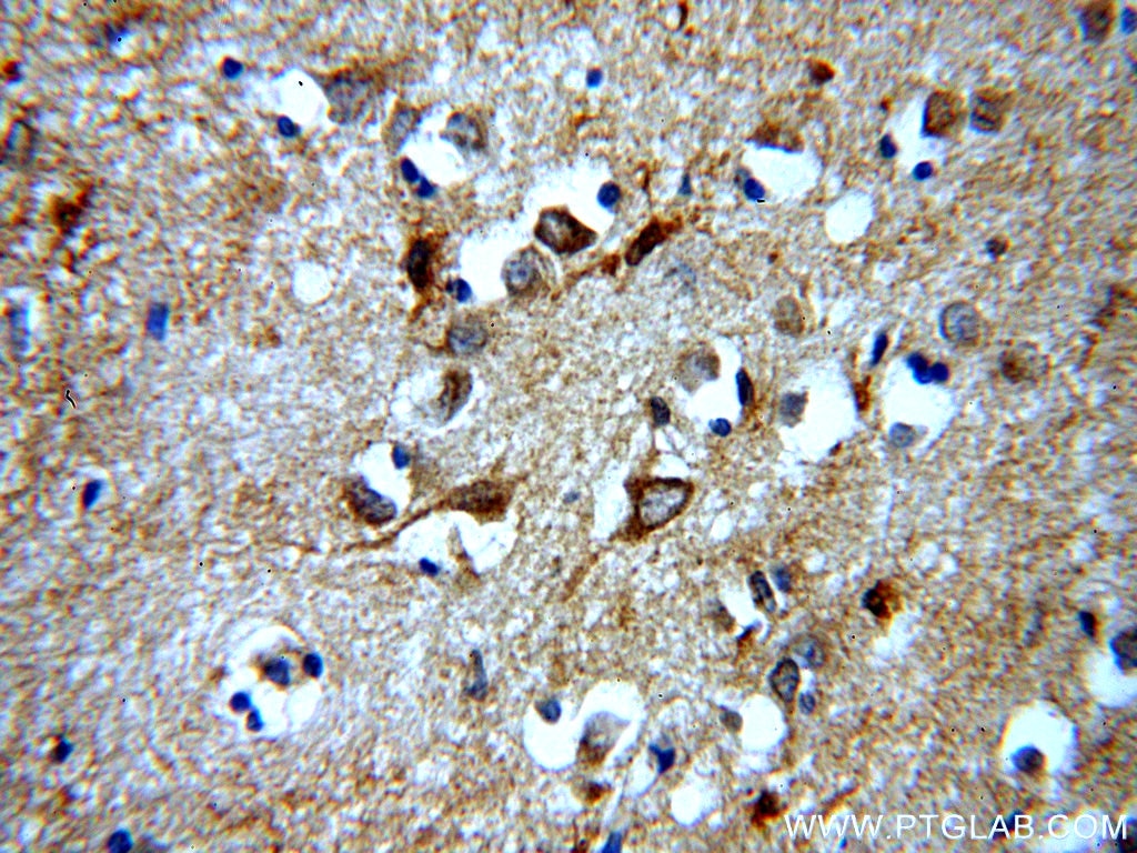IHC staining of human brain using 20226-1-AP
