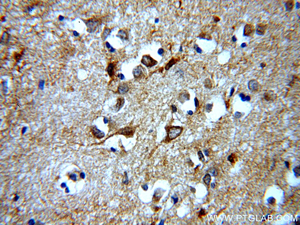 Immunohistochemistry (IHC) staining of human brain tissue using ARF1 Polyclonal antibody (20226-1-AP)