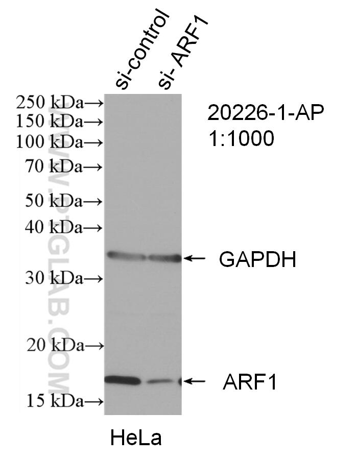 Western Blot (WB) analysis of HeLa cells using ARF1 Polyclonal antibody (20226-1-AP)