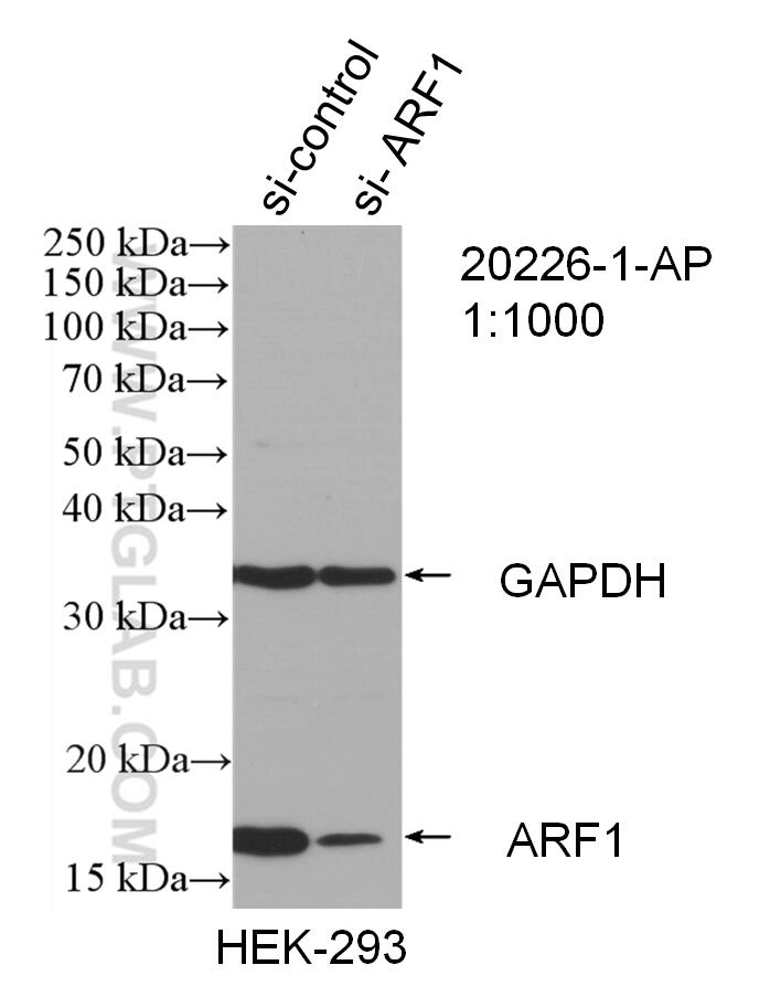 Western Blot (WB) analysis of HEK-293 cells using ARF1 Polyclonal antibody (20226-1-AP)