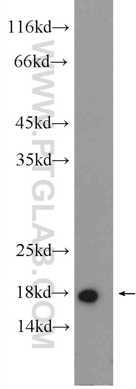 Western Blot (WB) analysis of HEK-293 cells using ARF1 Polyclonal antibody (20226-1-AP)