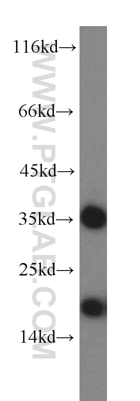 Western Blot (WB) analysis of mouse brain tissue using ARF1 Polyclonal antibody (20226-1-AP)