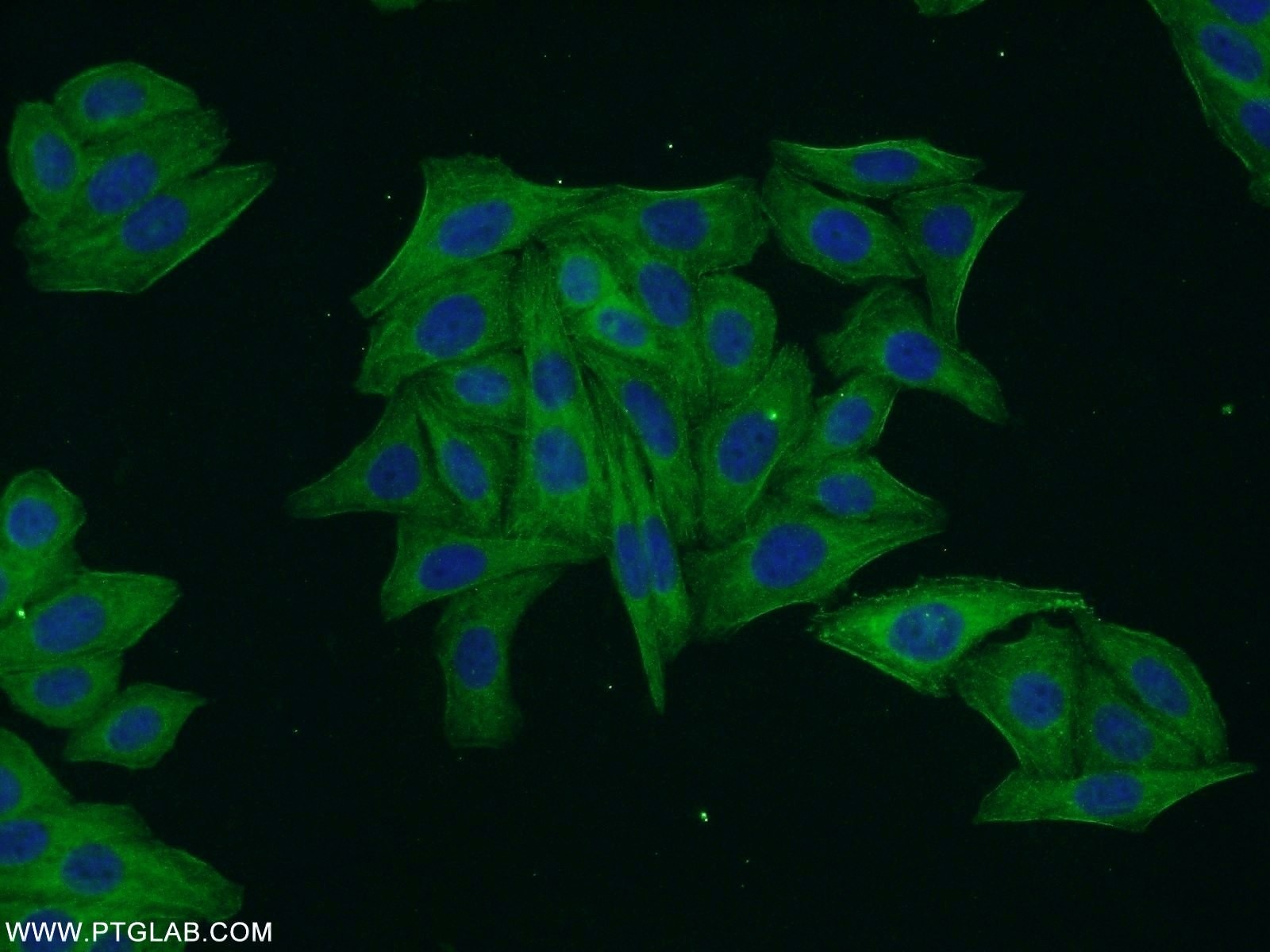 Immunofluorescence (IF) / fluorescent staining of HepG2 cells using ARF3 Polyclonal antibody (10800-1-AP)
