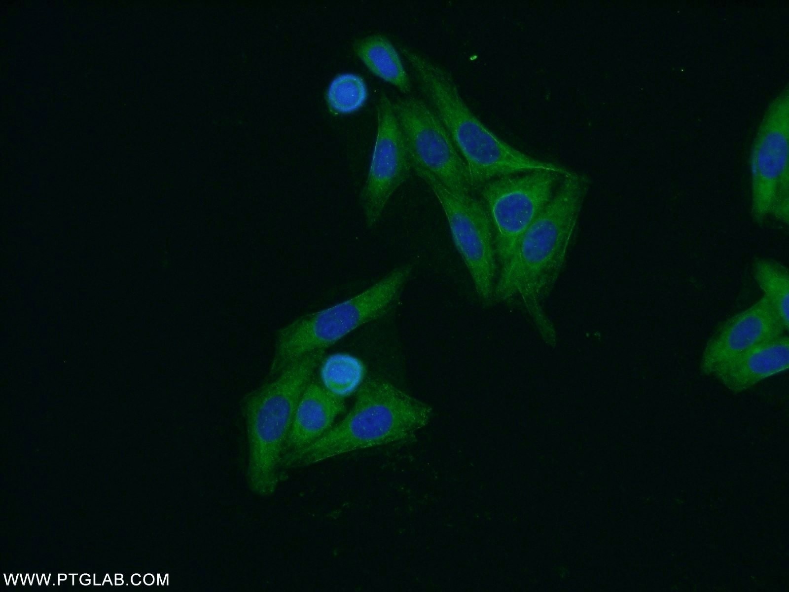 Immunofluorescence (IF) / fluorescent staining of HepG2 cells using ARF3 Polyclonal antibody (10800-1-AP)