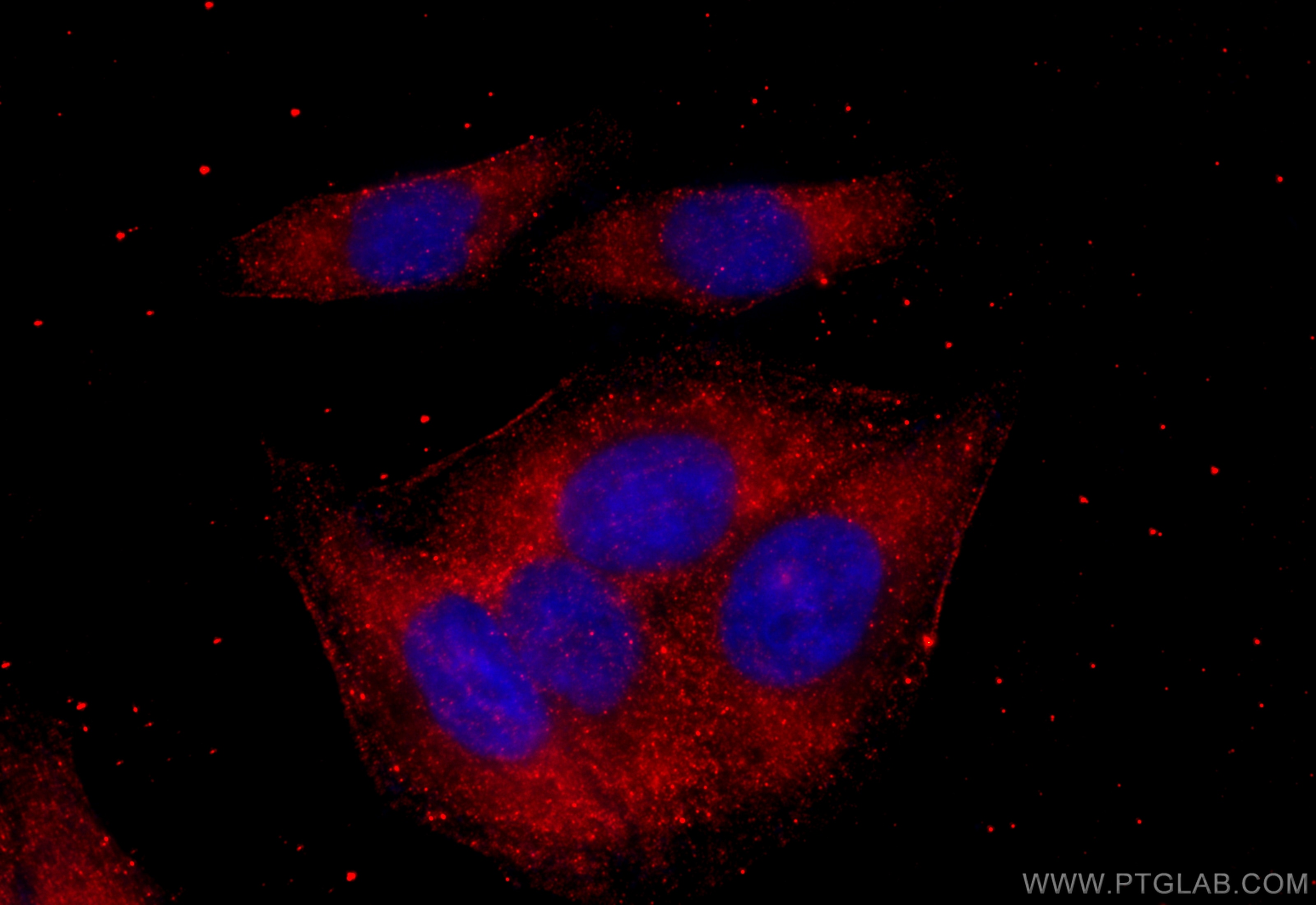 Immunofluorescence (IF) / fluorescent staining of HepG2 cells using ARF3 Polyclonal antibody (10800-1-AP)