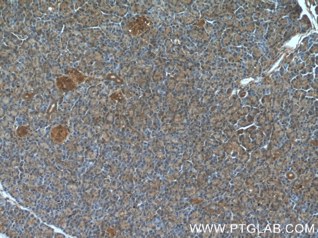 Immunohistochemistry (IHC) staining of human pancreas tissue using ARF3 Polyclonal antibody (10800-1-AP)