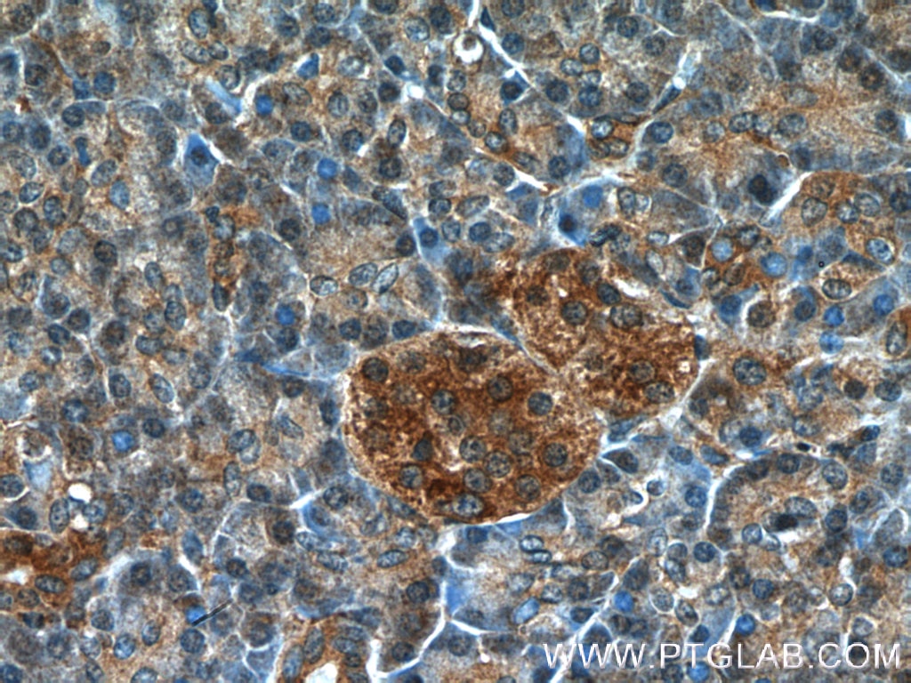 Immunohistochemistry (IHC) staining of human pancreas tissue using ARF3 Polyclonal antibody (10800-1-AP)