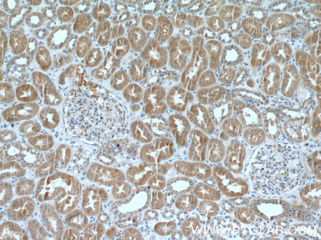 Immunohistochemistry (IHC) staining of human kidney tissue using ARF3 Polyclonal antibody (10800-1-AP)