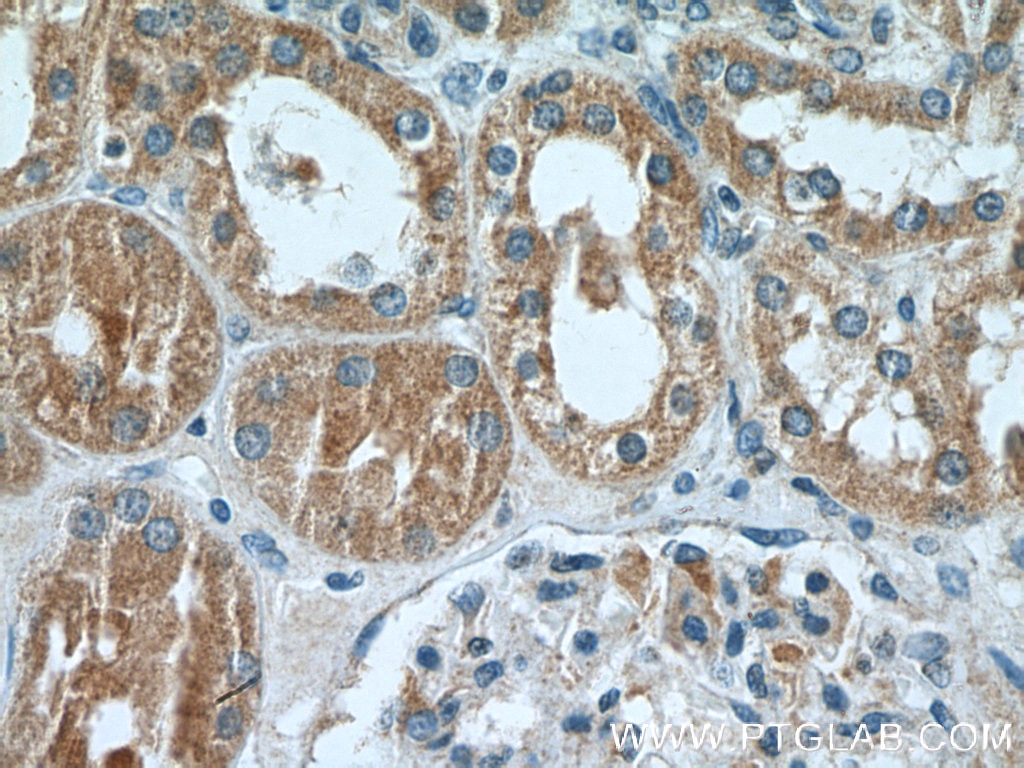 Immunohistochemistry (IHC) staining of human kidney tissue using ARF3 Polyclonal antibody (10800-1-AP)