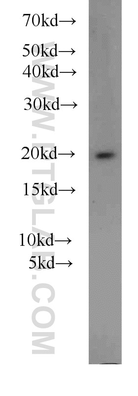 Western Blot (WB) analysis of mouse brain tissue using ARF3 Polyclonal antibody (10800-1-AP)