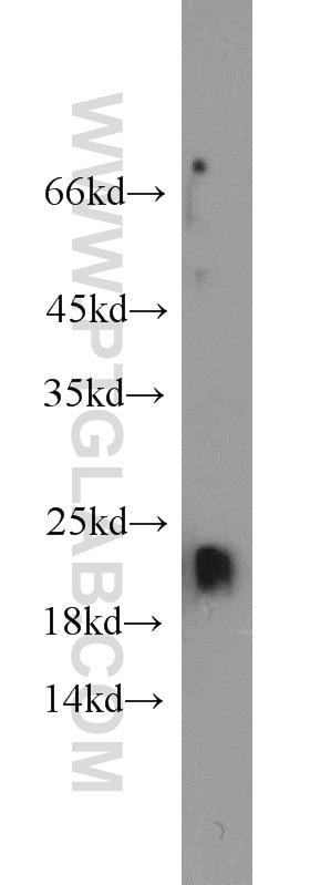Western Blot (WB) analysis of rat brain tissue using ARF3 Polyclonal antibody (10800-1-AP)