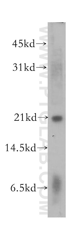 Western Blot (WB) analysis of human brain tissue using ARF3 Polyclonal antibody (10800-1-AP)