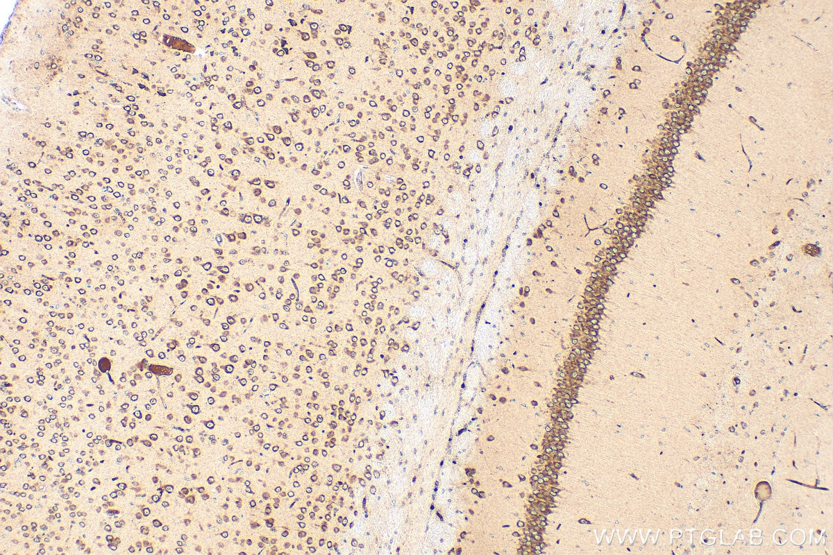 Immunohistochemistry (IHC) staining of mouse brain tissue using ARF3 Polyclonal antibody (22289-1-AP)