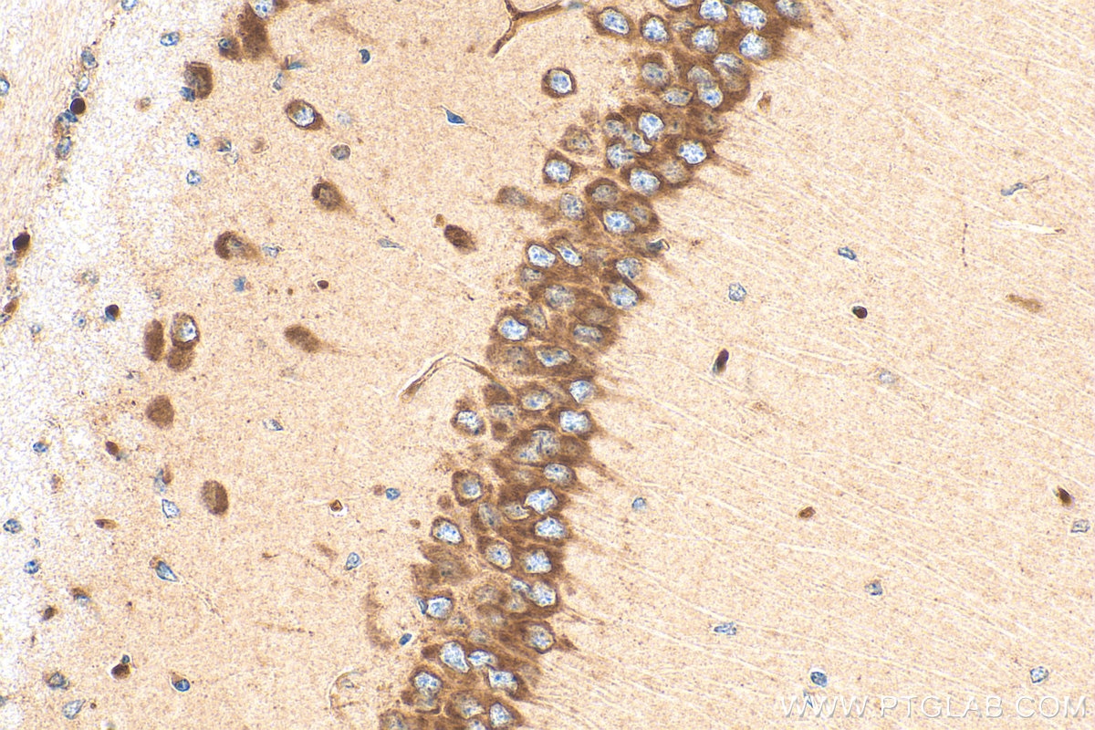 Immunohistochemistry (IHC) staining of mouse brain tissue using ARF3 Polyclonal antibody (22289-1-AP)