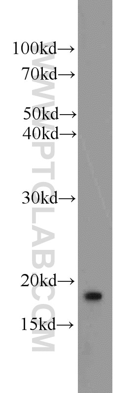 Western Blot (WB) analysis of rat brain tissue using ARF3 Polyclonal antibody (22289-1-AP)