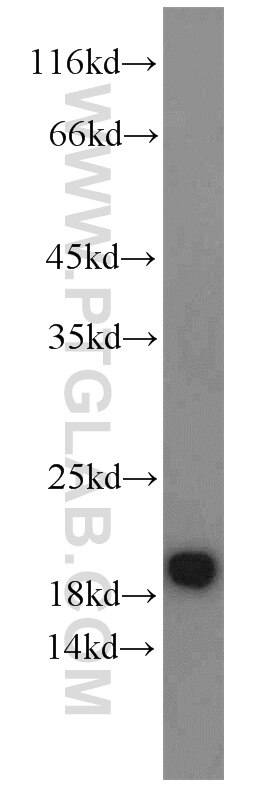 Western Blot (WB) analysis of mouse brain tissue using ARF3 Polyclonal antibody (22289-1-AP)