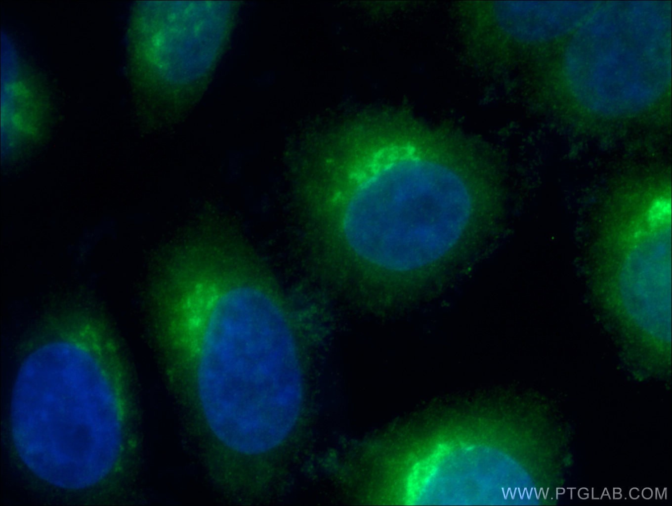 Immunofluorescence (IF) / fluorescent staining of HepG2 cells using ARF4 Polyclonal antibody (11673-1-AP)