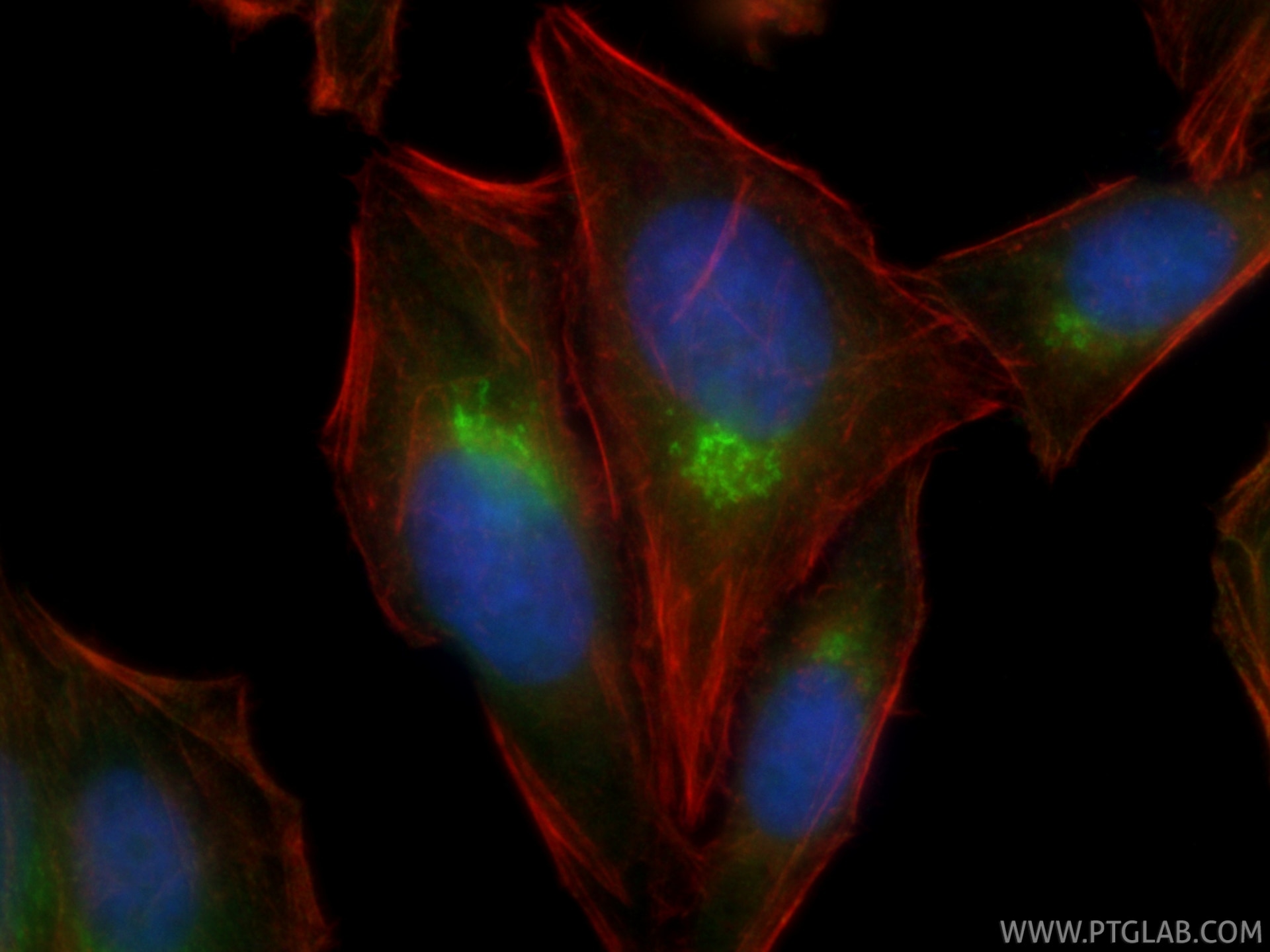 IF Staining of HepG2 using 11673-1-AP Immunofluorescence (IF) / fluorescent staining of HepG2 cells using ARF4 Polyclonal antibody (11673-1-AP)