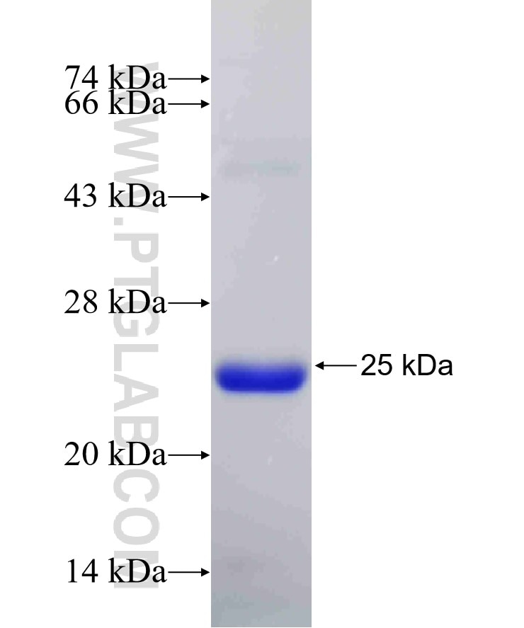 ARF4 fusion protein Ag32663 SDS-PAGE ARF4 fusion protein Ag32663 SDS-PAGE