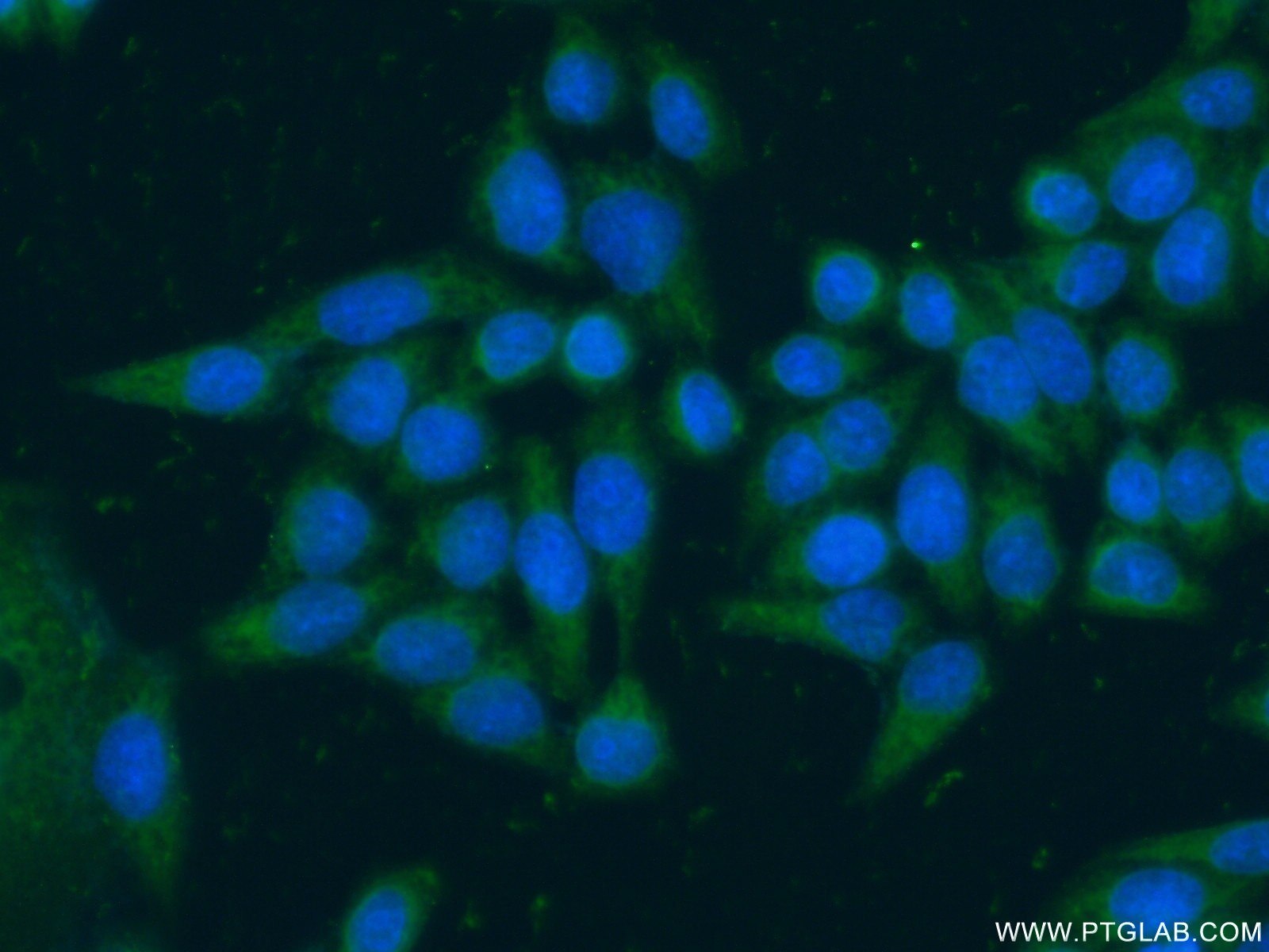 Immunofluorescence (IF) / fluorescent staining of HeLa cells using ARF5 Polyclonal antibody (15281-1-AP)