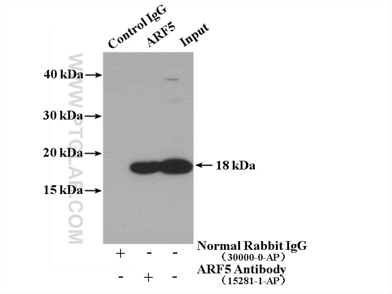 Immunoprecipitation (IP) experiment of MCF-7 cells using ARF5 Polyclonal antibody (15281-1-AP)